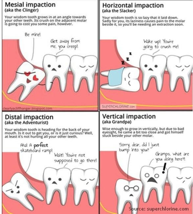 wisdom tooth eruption