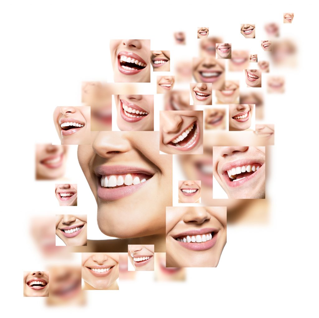 smiles-of-different-women-with-upper-teeth-showing