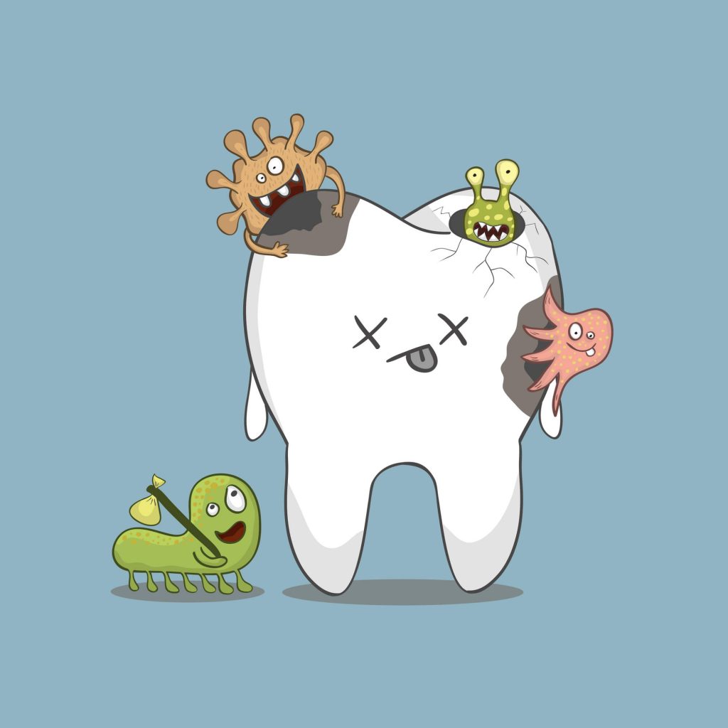 illustration of tooth with cavity pediatric dentist Zebulon