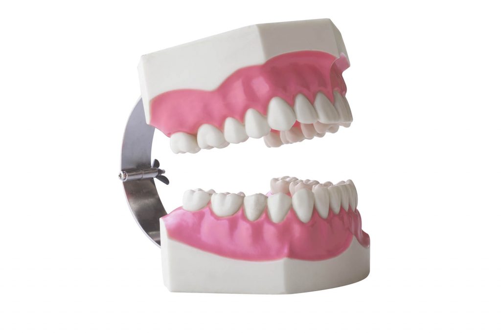 dentist Wendell shows illustration of dentures