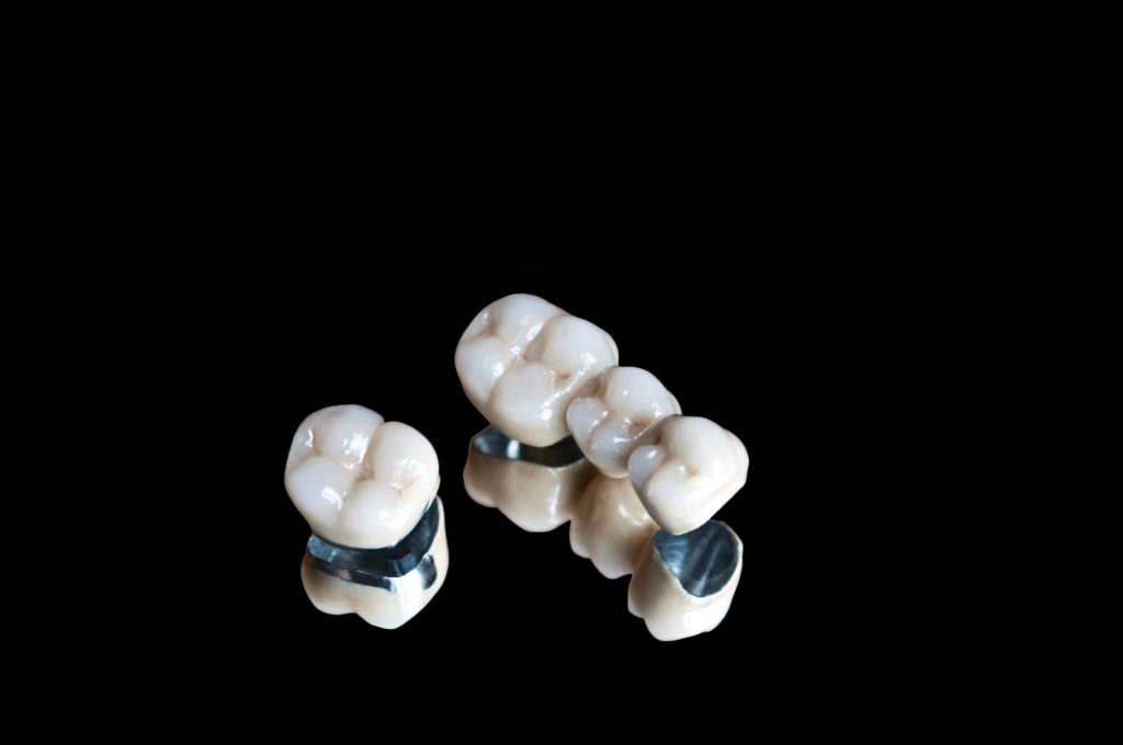 image of dental crown Wilson 