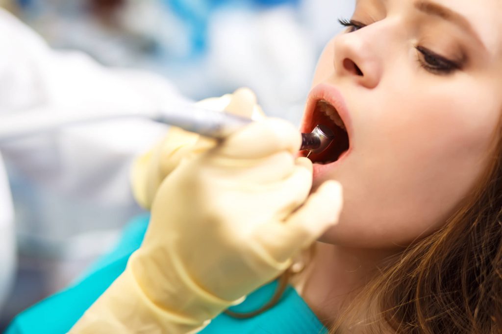 dentist examining patient's composite fillings in Raleigh