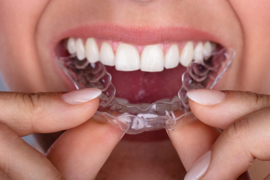 cosmetic dentist in Raleigh provides patient with new set of clear aligners