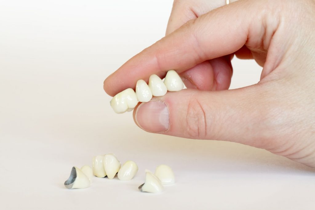 porcelain dental crown bridge in Clayton shown by a dentist