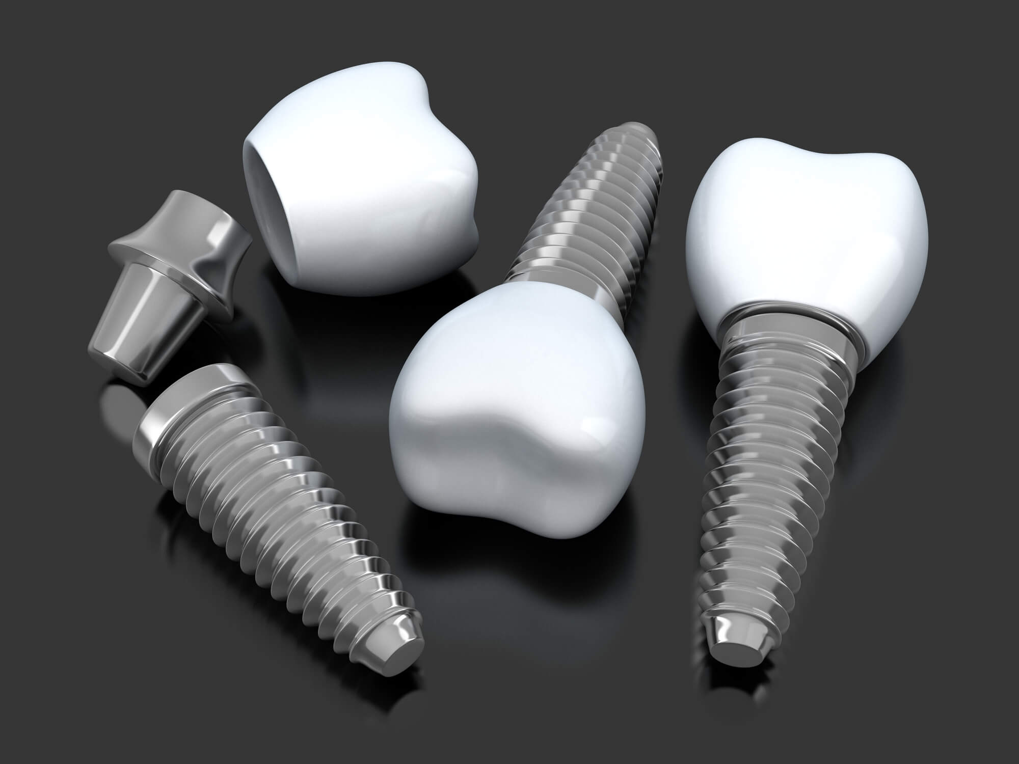 three dental implants in Wilson